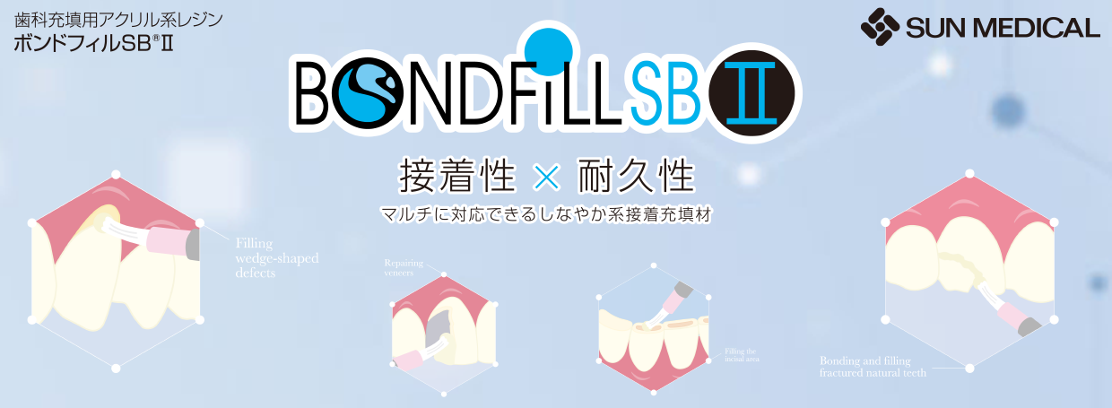 ボンドフィルＳＢ®Ⅱ