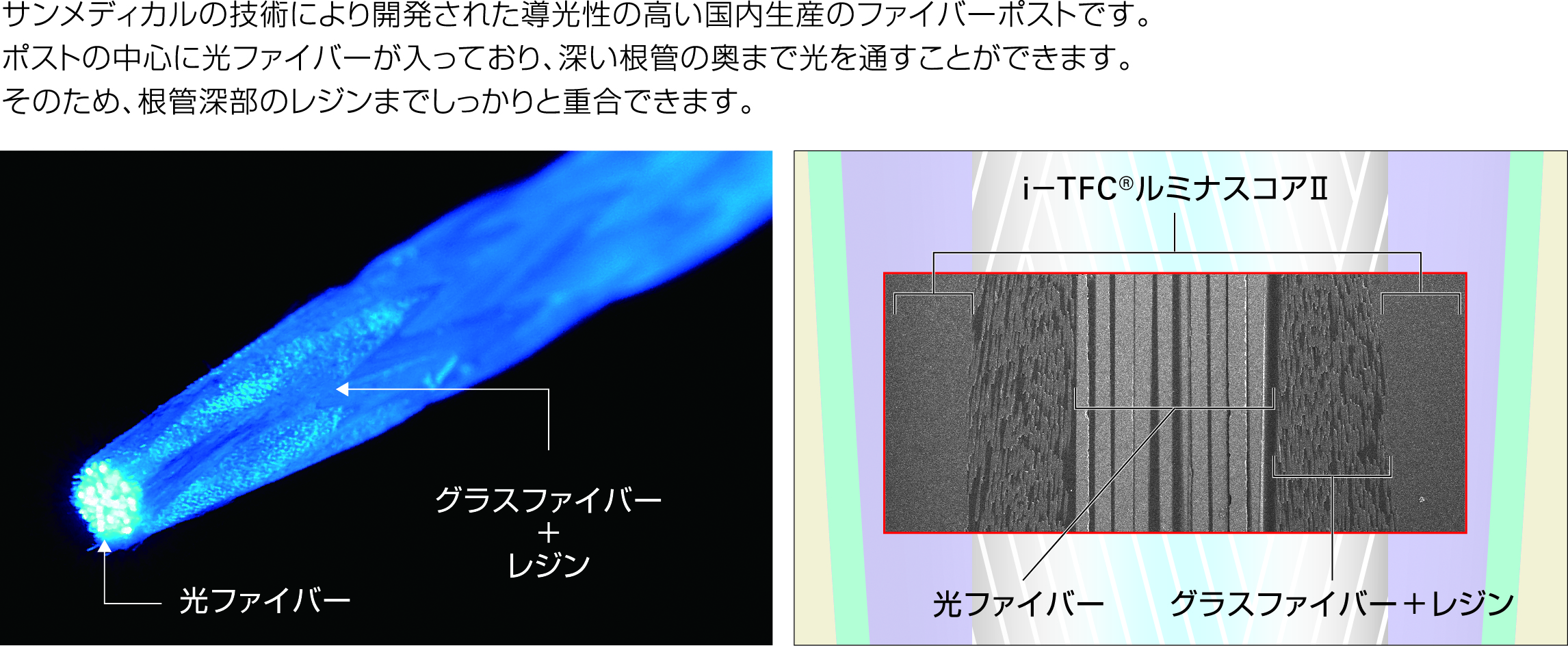 導光性の高い光ファイバーを採用