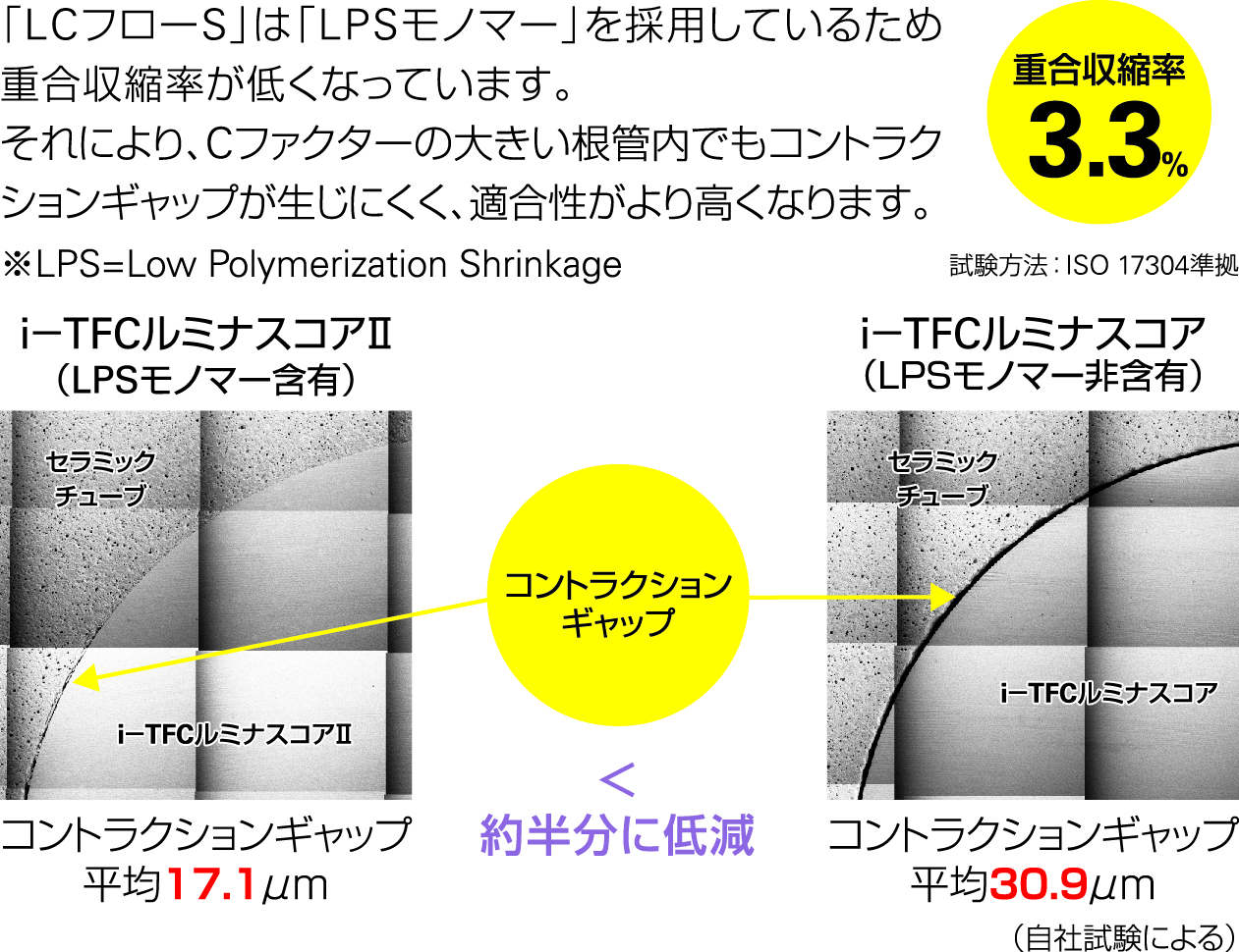 低重合収縮モノマー「LPSモノマー®」採用