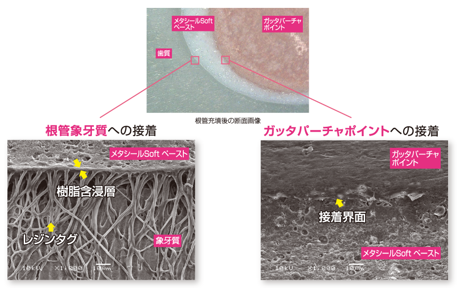 「接着」で封鎖性が高い