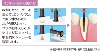 エンドノズルの使い方