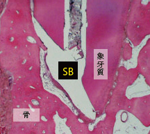 48週後