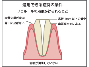 適用できる症例の条件