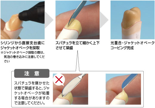 スパチュラを使用する場合