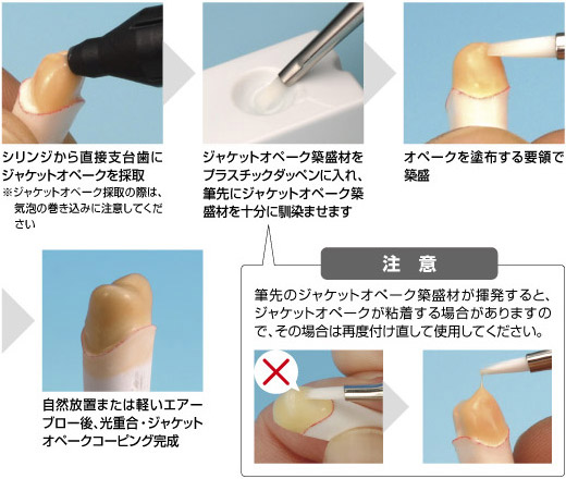 筆（ジャケットオペーク築盛材を併用）を使用する場合