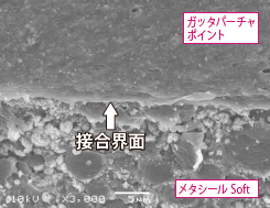 「メタシール Ｓｏｆｔ」とガッタバーチャポイントの界面